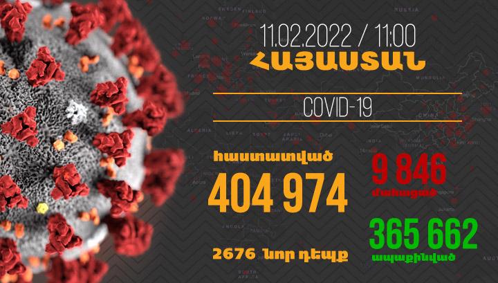 Հայաստանում հաստատվել է կորոնավիրուսով վարակվելու 2676 նոր դեպք. Մահացել է 29 քաղաքացի
